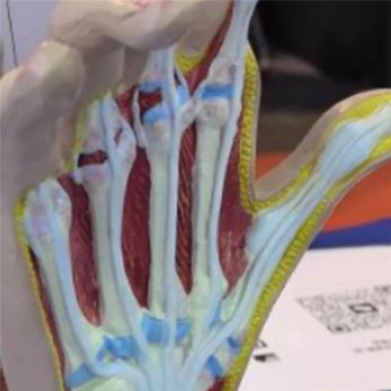 

EDT-Osteoarthritis Hand Model, Model Of Hand Pathology, Human Anatomy And Physiology Replica, 's Office Anatomy Model