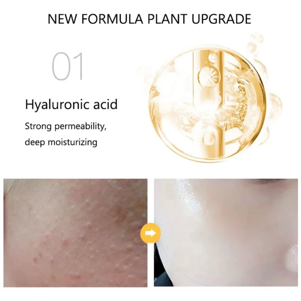 Essência de Niacinamida para Cuidados Faciais, Essência Dourada 24K, Anti Rugas, Anti-envelhecimento, Ácido hialurônico, Hidratante, Anti-envelhecimento, Nutritivo, Pele