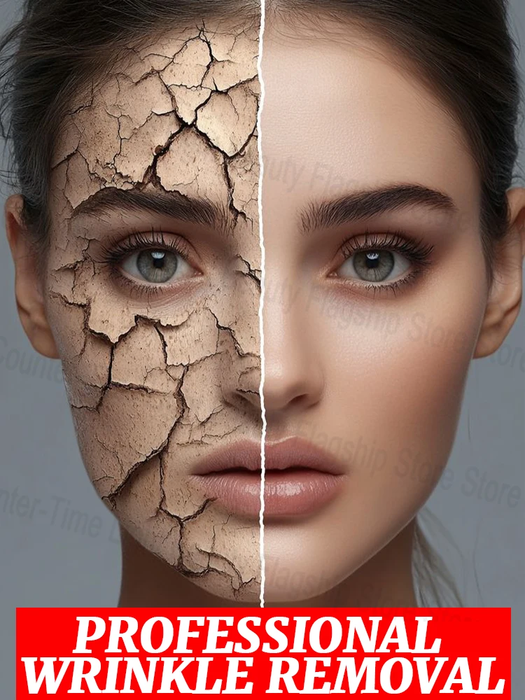 

20 years younger, no more wrinkles