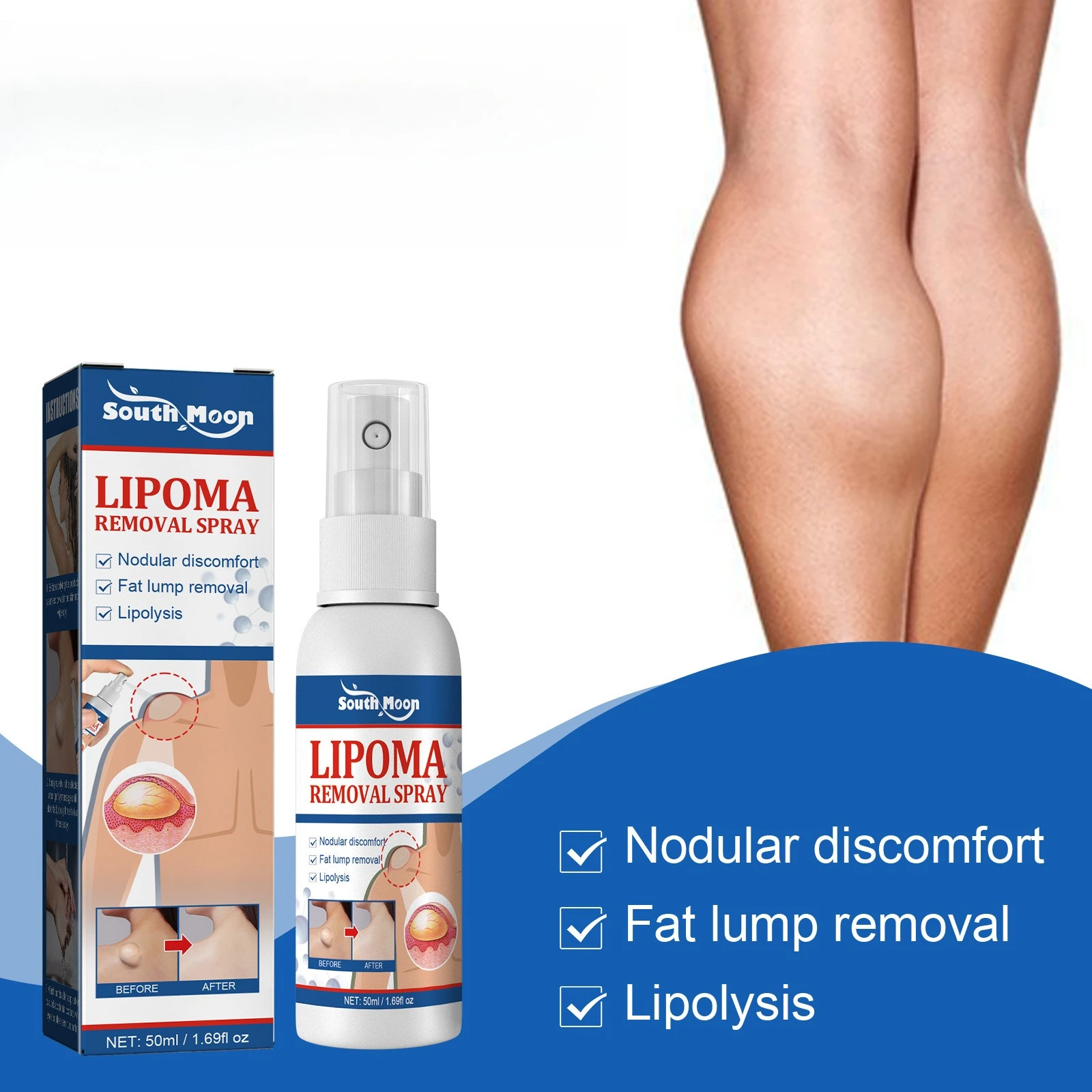 

Лапка Антистресс Спрей для жировых узлов Снимает грудь тела Спрей для выемки подложных уздел Крем для удаления целлюлита и жира в ножнилах 50 мл 교정