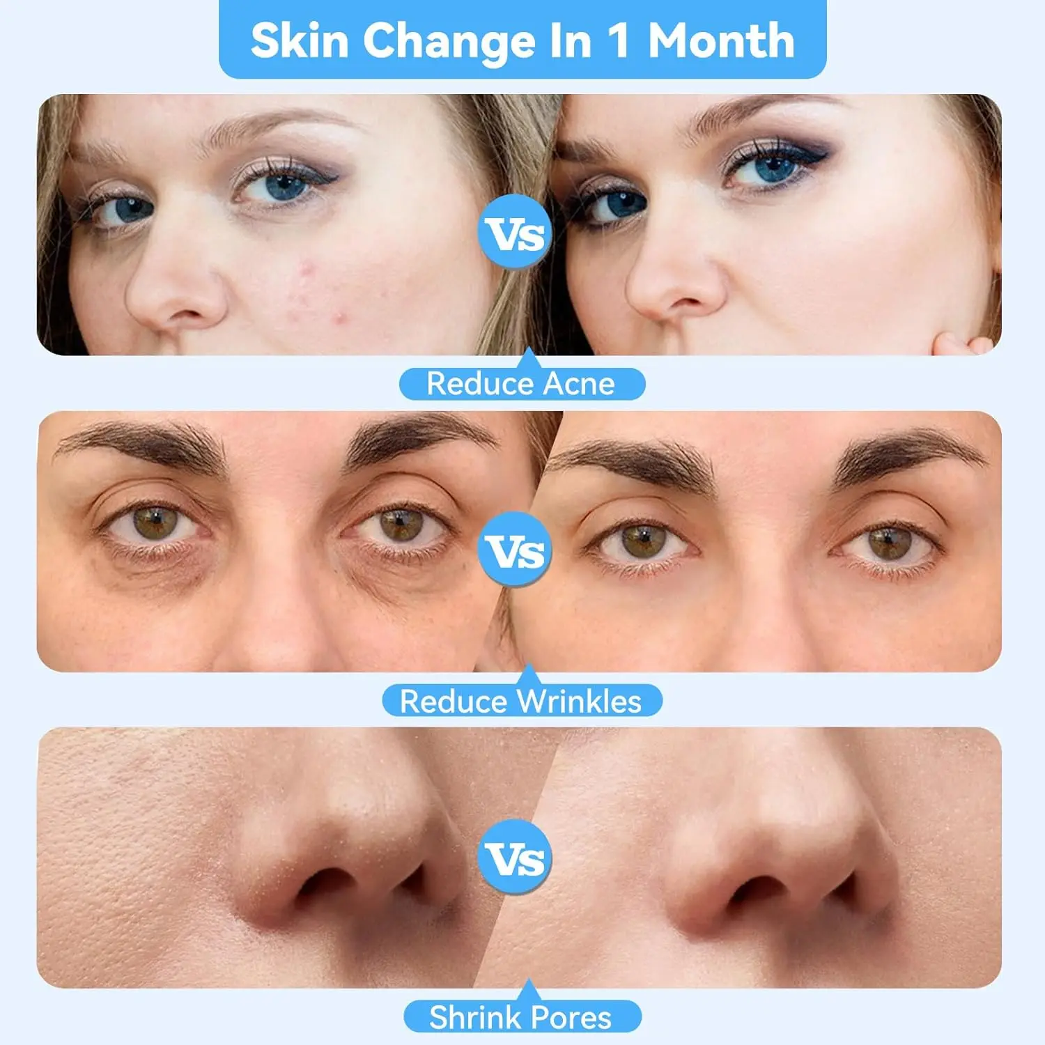 스프레이, 얼굴 필링 미용 장치 여드름 제거 여드름 청소 도구와 새로운 휴대용 다이아몬드 미세 박피 기계