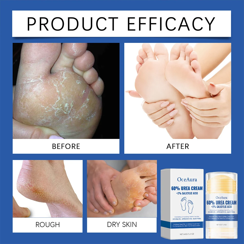 40 جرام كريم القدم المضاد للتكسير إنقاذ القدم المتشققة تقشير القدم مرهم القدم ترطيب عصا للأقدام الجافة المتشققة #3