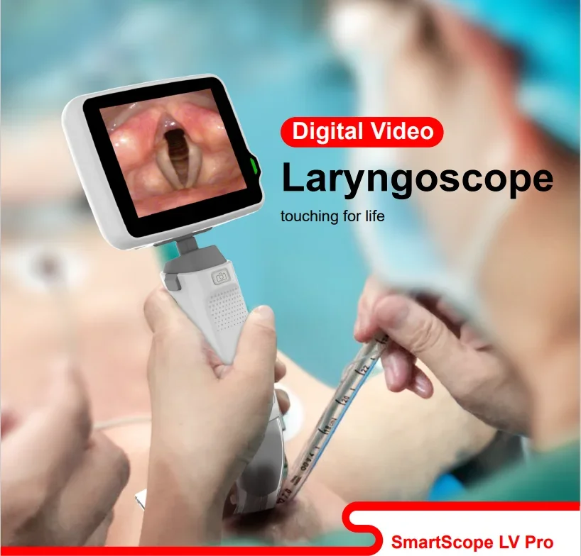 Flexible Video Laryngoscope Digital HD video laryngoscope Wireless Charging SmartScope Adult And Pediatric Laryngoscope