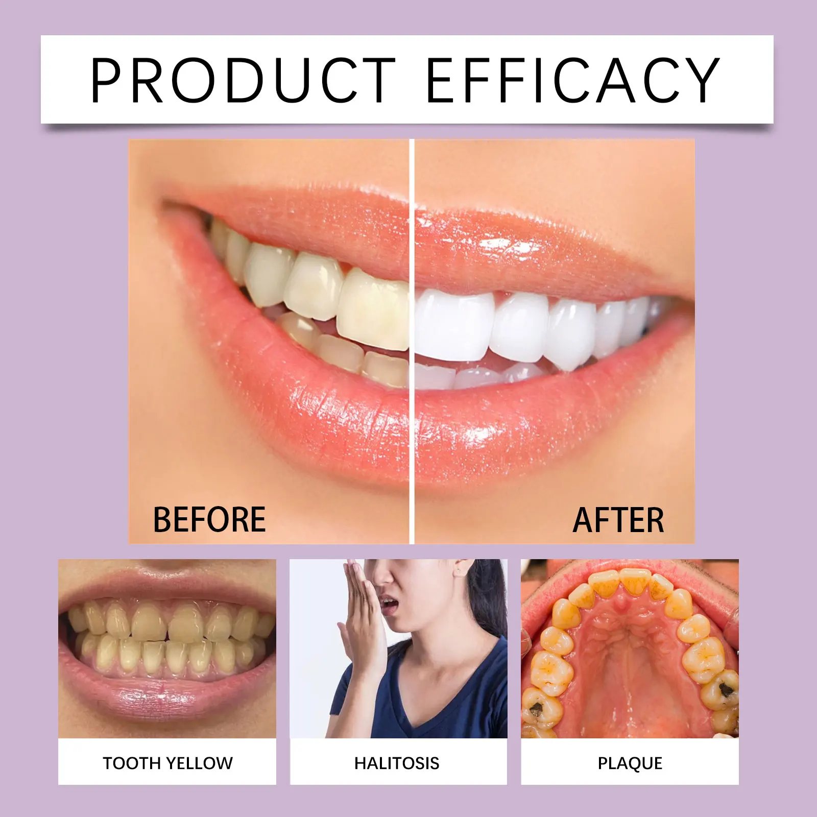 Thumbnail 3 - #79 Best Selling Teeth Whiteners