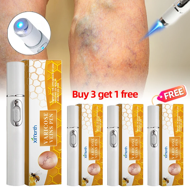 

4pcs Leg Repair Laser Pen Varicose Veins Relief Medicine Vasculitis Phlebitis Removal Improve Blood Circulation