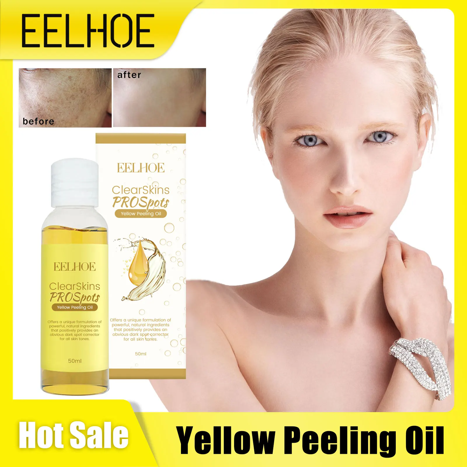 Yellow Peeling Oil Bleaching Brightening Dark Spots Body Knees Exfoliating Remove Dead Skin Lightening Melanin Whitening Serum