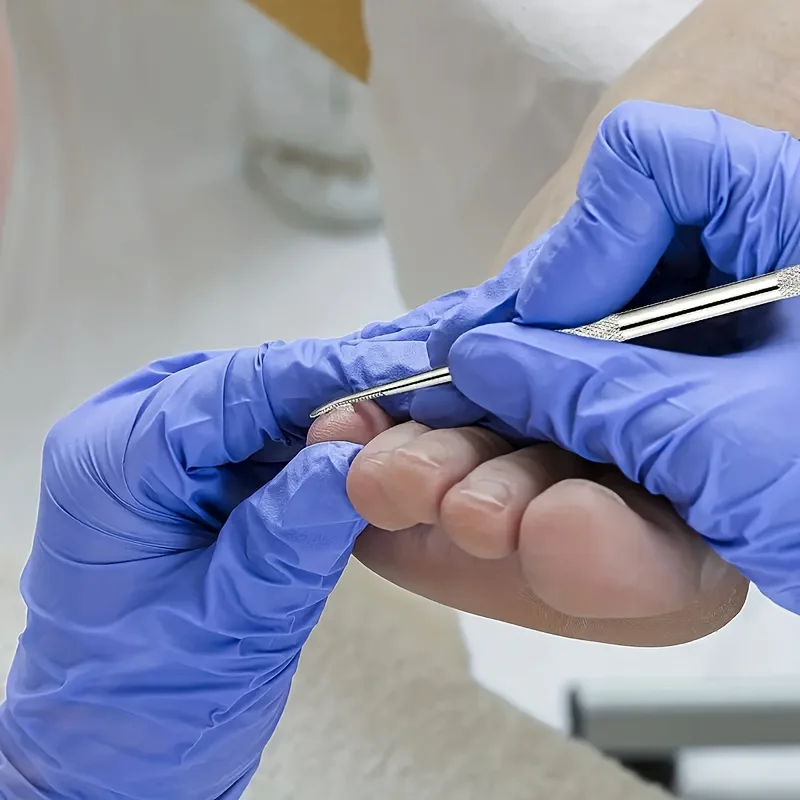 Ferramenta profissional para unhas encravadas em aço inoxidável, 3 peças, ferramentas para limpeza de unhas com aderência texturizada para experiência de pedicure aprimorada