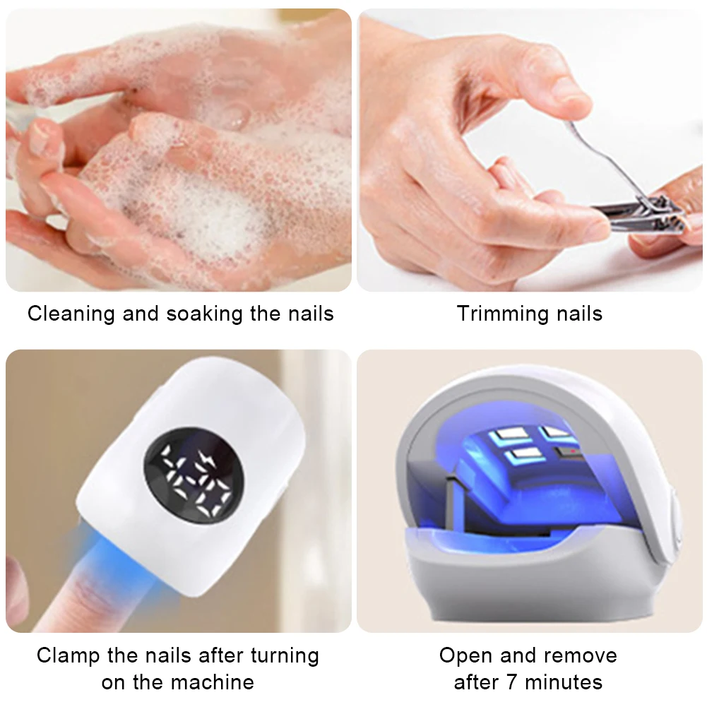 Laserbehandlung Zur Nagelpilzbekämpfung Und Fußpflege_voghion.com