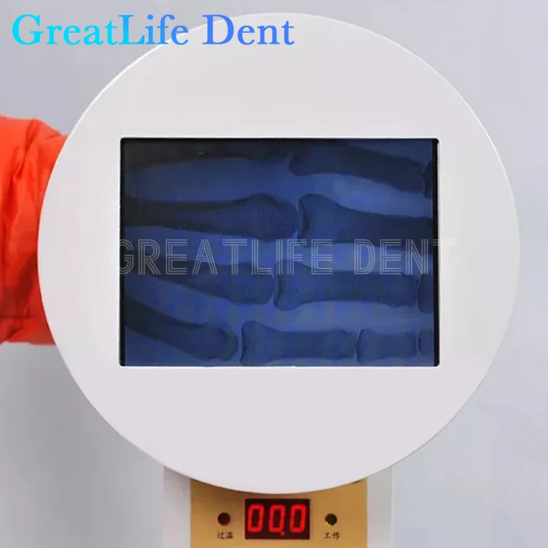 GreatLife Dent 75Kv Portable Handheld Small X Ray Digital Fluoroscopy Machine Scanner For Pets Animals Dog Cat With 15LCD Screen