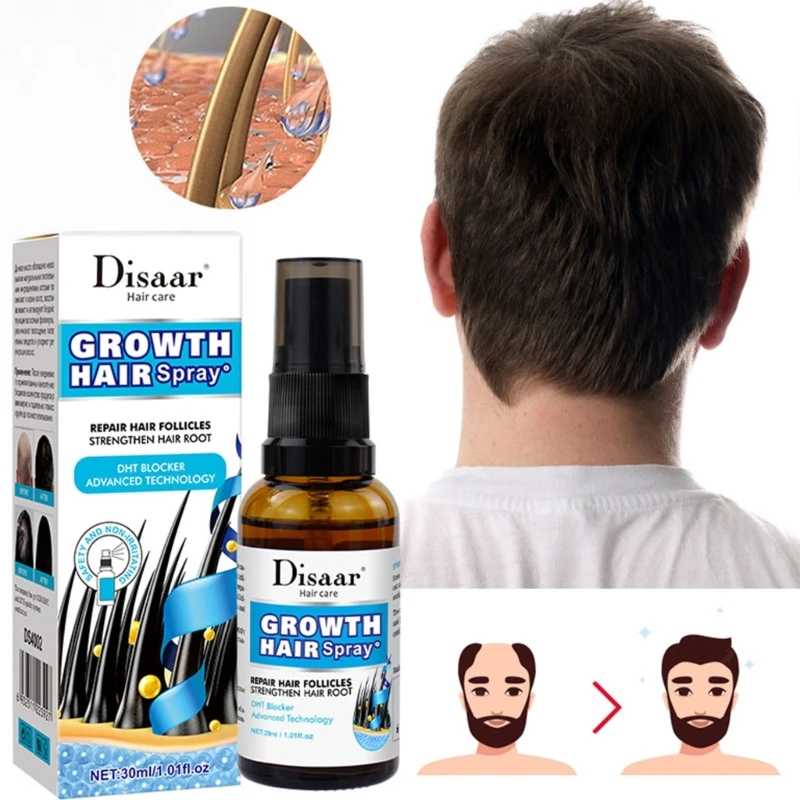 Traitement sérum d'huile croissance cheveux pour perte cheveux l'amincissement repousse des cheveux