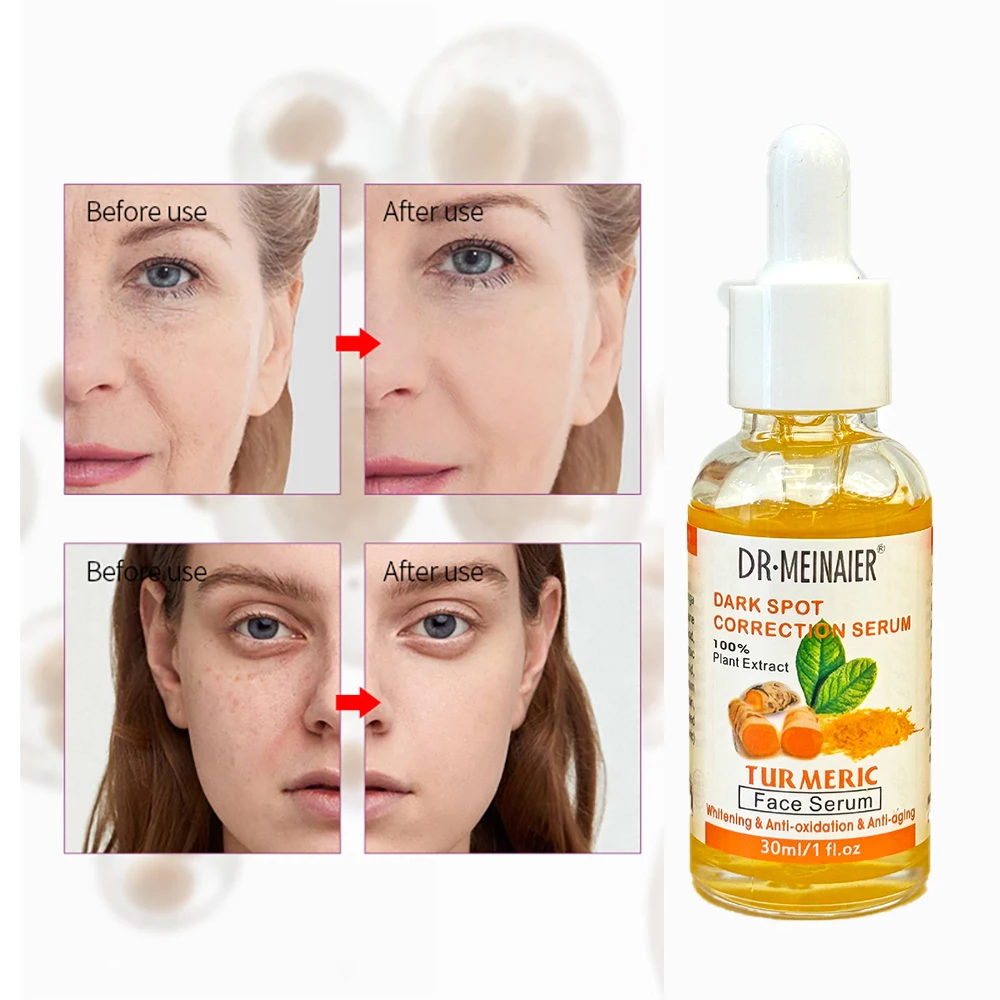 

12PCs Turmeric Serum Oil Facial Skin Care Essence Moisturizing Brighten Turmeric Oil Face Care Dry Skin Redness Dark Skincare
