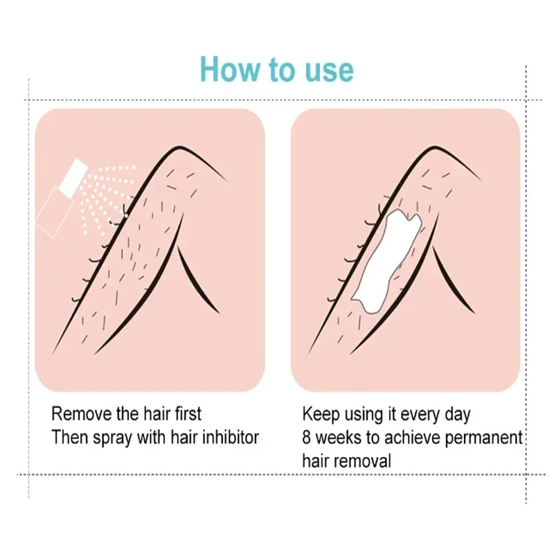 สเปรย์ obat penghilang rambut permanen กำจัดขนอย่างรวดเร็วรักแร้ขาแขนผมยับยั้งการเจริญเติบโตของเส้นผมยับยั้งการกำจัดขนเรียบบำรุงความงามดูแลร่างกาย