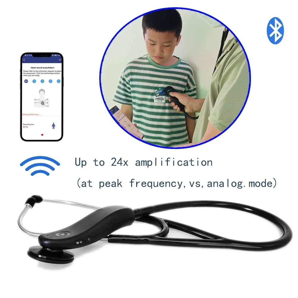 Digital bluetooth wireless stethoscope, intelligent electronic stethoscope