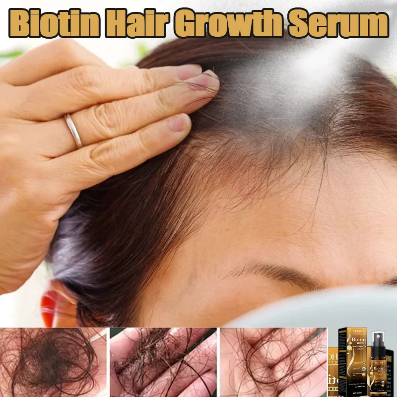 

Биотинный спрей для волос, восстановление повреждений, масло для восстановления кожи головы, сыворотка-спрей, 20 мл для мужчин и женщин, утолщенные волосы, уход за здоровьем, новинка