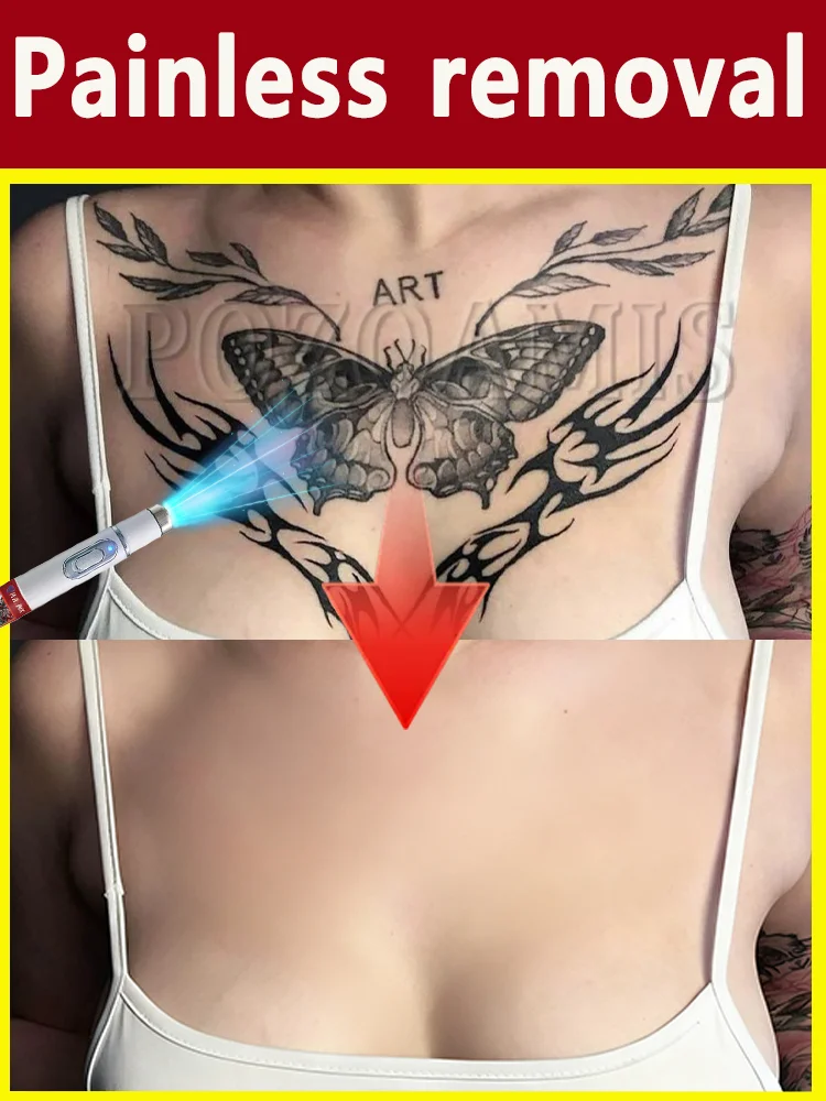 

Удаляет депозиты пигментации быстро независимо от размеров.