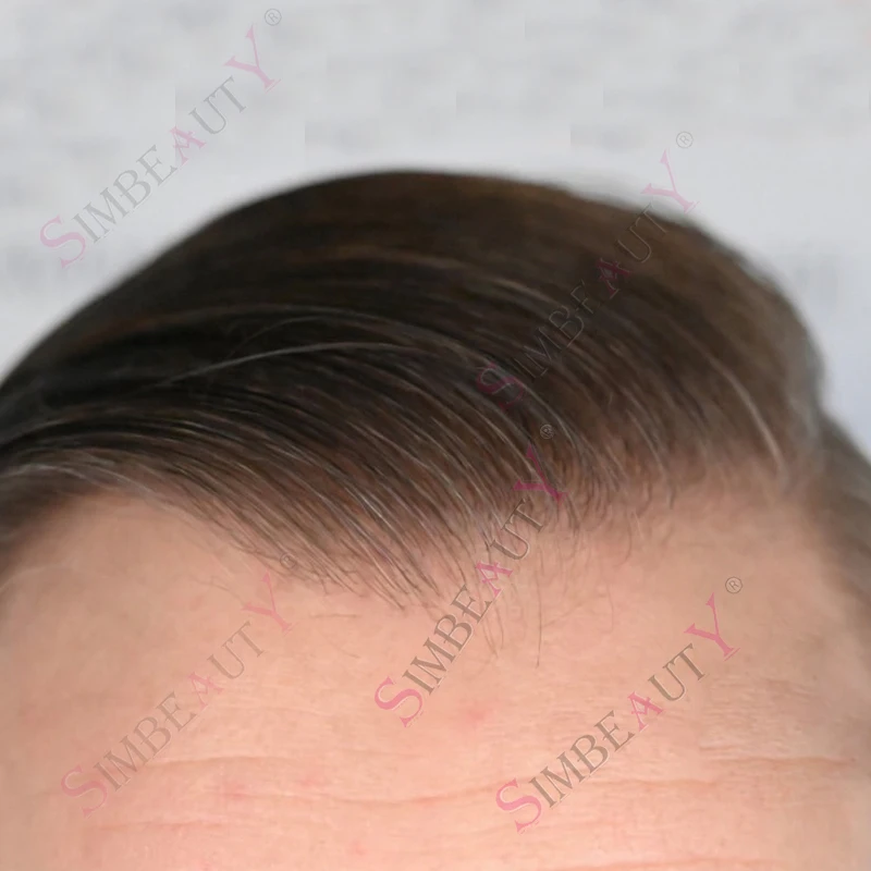 

Натуральный материал 610, плотность 80% # Светло-коричневый серый парик из волос Реми, ультратонкая микроскользящая основа 0.02 мм, мужской тупе, система замещения волос для мужчин, светлые и черные оттенки