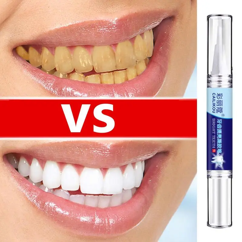 

Professional Tooth Whiten Pen Teeth Whitener And Stain Remover Travel-Friendly No Sensitivity Effective Tooth Whiten Pens