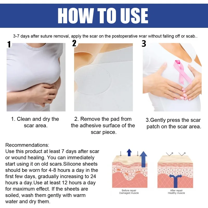 Female Silicone Breast Scar Removal Sheets Stickers for Nipples Scar Removal Sticker Acne Trauma Breast  Scar Sheets Skin Repair