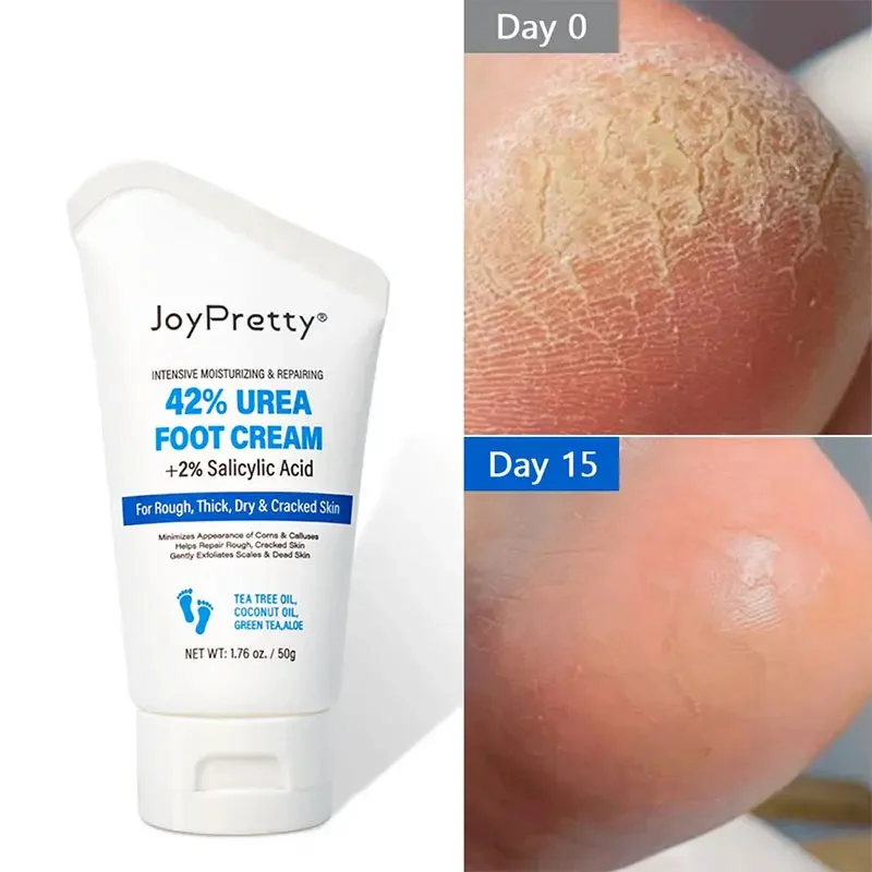 

50g Exfoliator Foot Cream Dead Skin Remover Heel Crack Repair Cream Treatment Moisturizing Hand Feet Skin Care Foot Mask