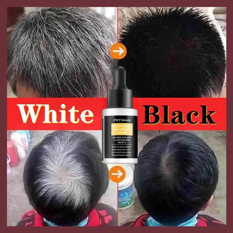 White Hair Treatment Essence Repairs Natural Color Prevents Gray Hair Shampoos  Anti Loss Hair Rgrowth Men Women Care Products