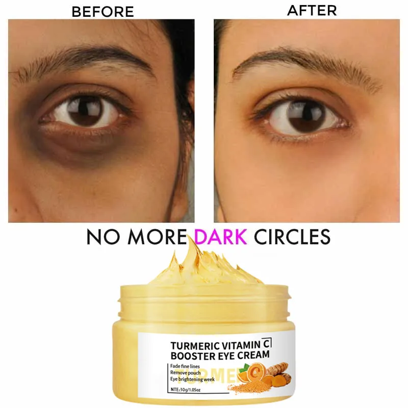 

30G Turmeric Eye Cream Dark Circles Remover Eye Bags Lift Firm Brightening Vitamin C Eye Cream Anti Aging Massage Eyes Care