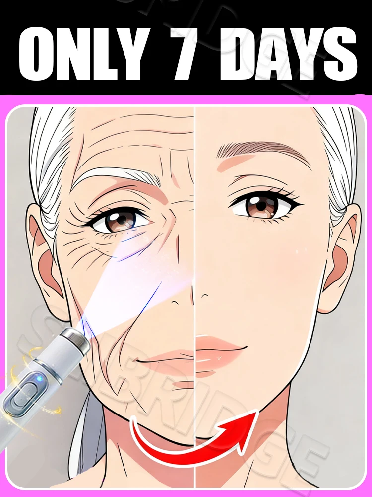 

2025 New Upgrade Blue Laser Solve wrinkles Tool