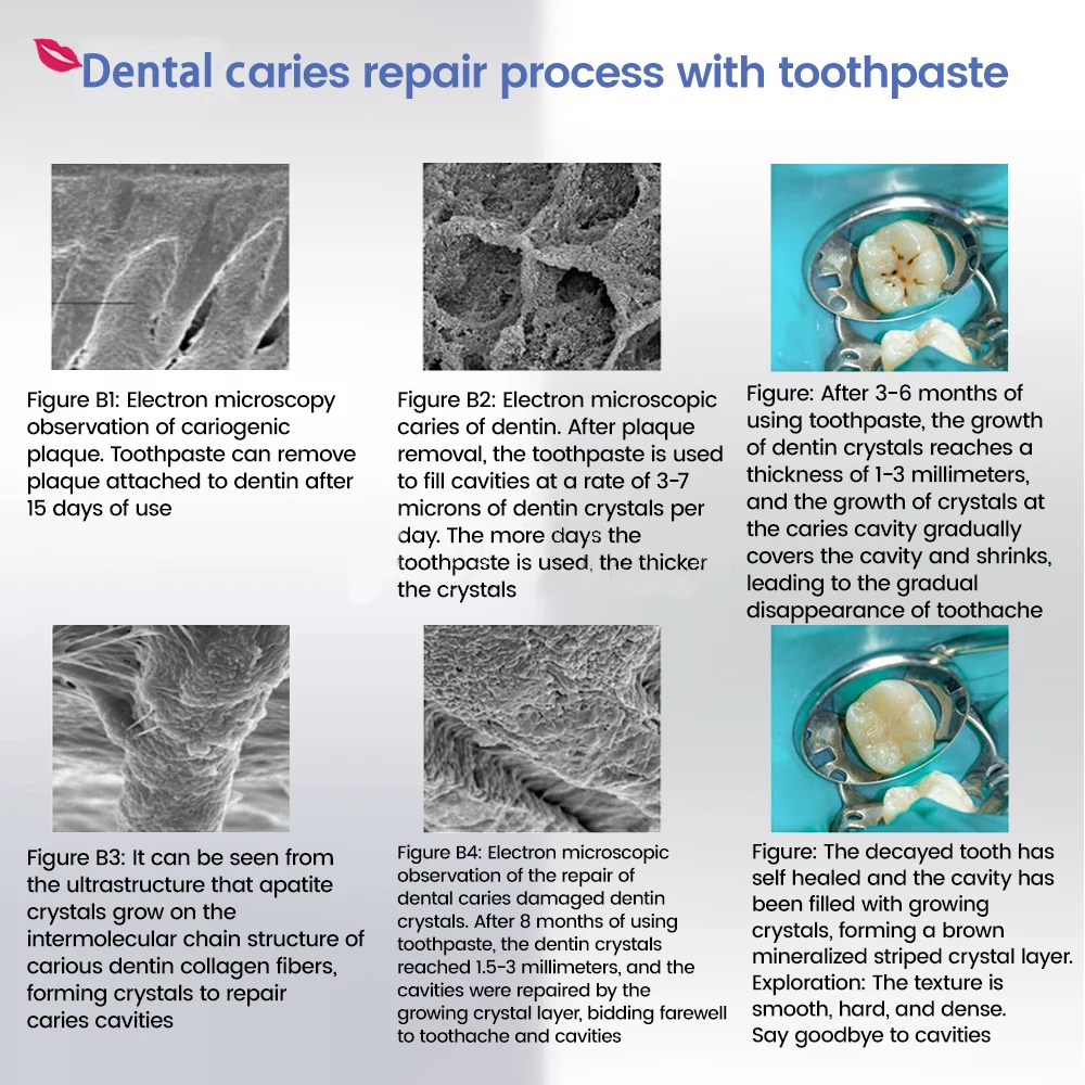 Toothpaste of Teeth Whitening Repair of Cavities Caries Removal of Plaque Stains Decay Repair Teeth Treating Dental Calculus