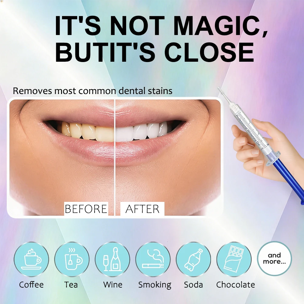 Gel sbiancante per denti al gu - Teeth Whitening At Home Kit recensione e prezzo