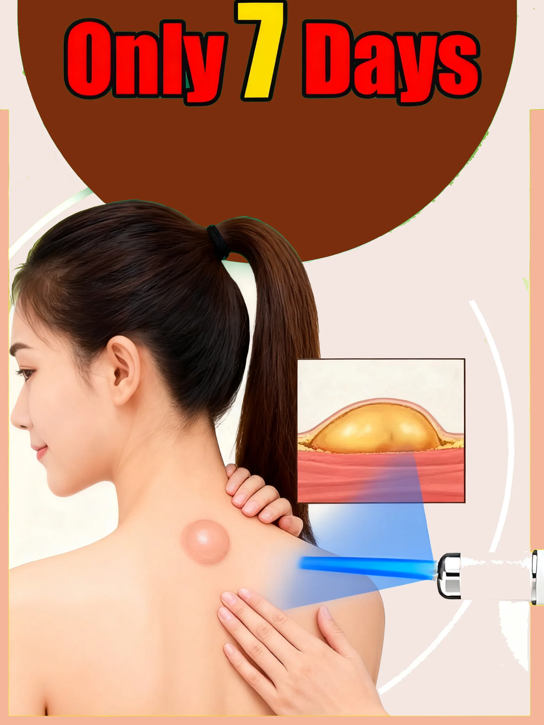 

Самый продаваемый бытовой многофункциональный набор лазерных ручек синего света 2025 года, инструмент для ухода за кожей