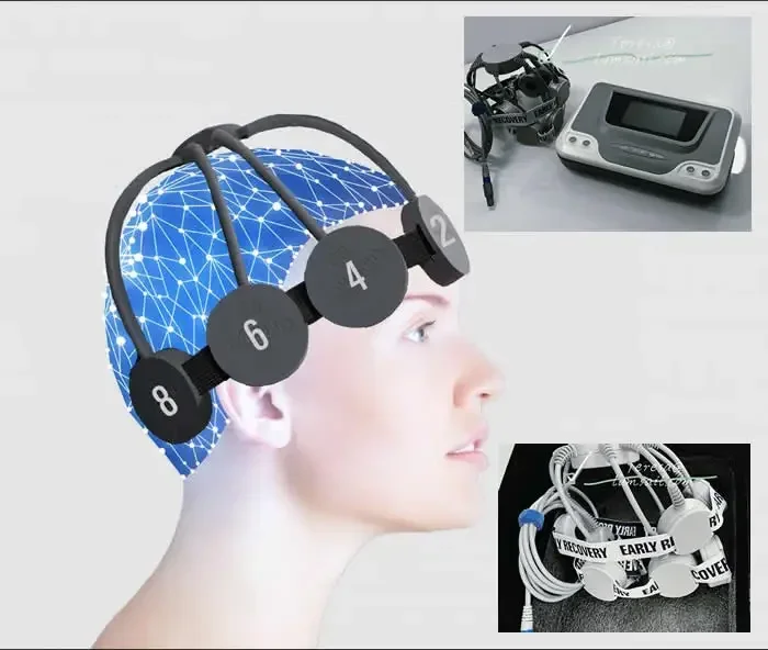 1-50HZ Adjustable Frequency Mental Illness Brain Rehabilitation Repetitive Transcranial Magnetic Stimulator RTMS