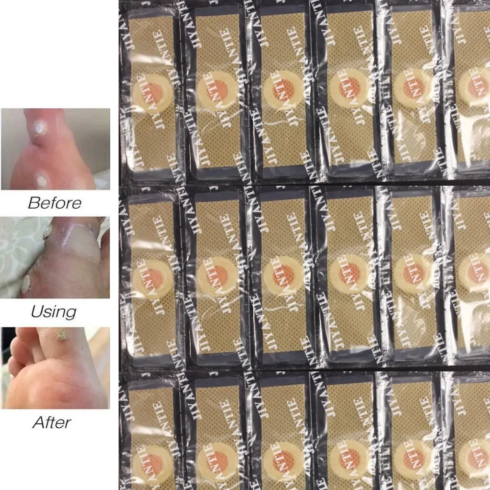 Naklejki do pielęgnacji stóp Plaster medyczny Kurze oko Nagniotki Plastry Usuwanie Nagniotków na stópach Środek na odciski Nauchniki na stópach Plaster na kolce