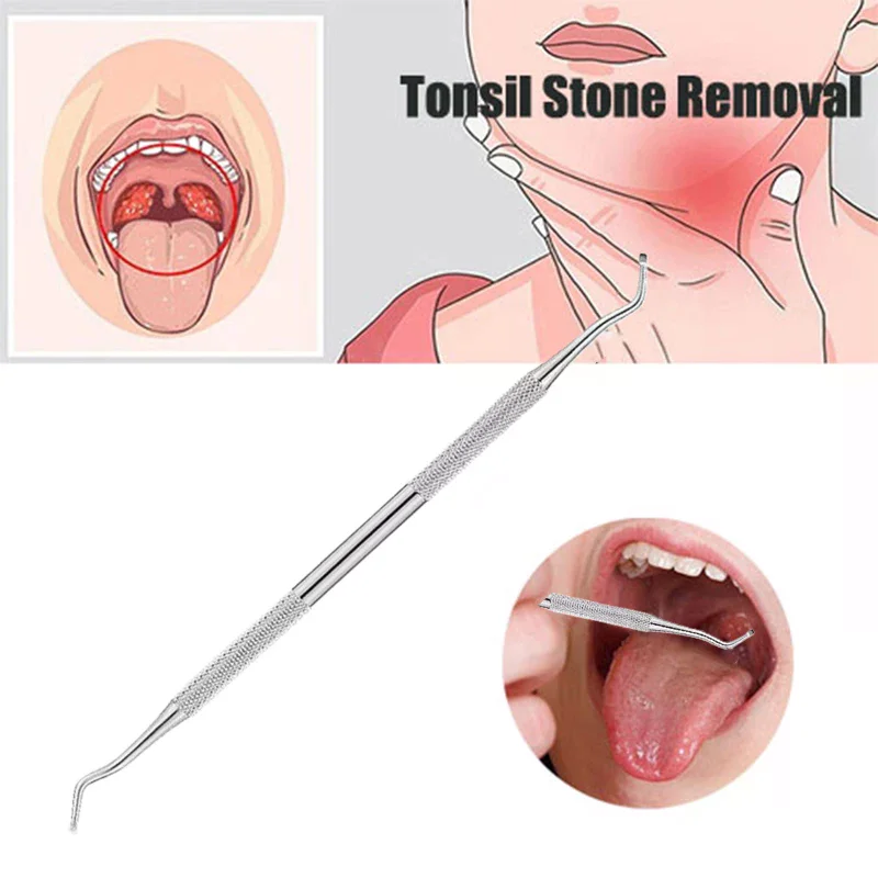 1pc Tonsil Stone Removal Ear Wax Remover Tool With Stainless Steel - Mouth Cleaning Care Tools For Tonsil Stone Removal