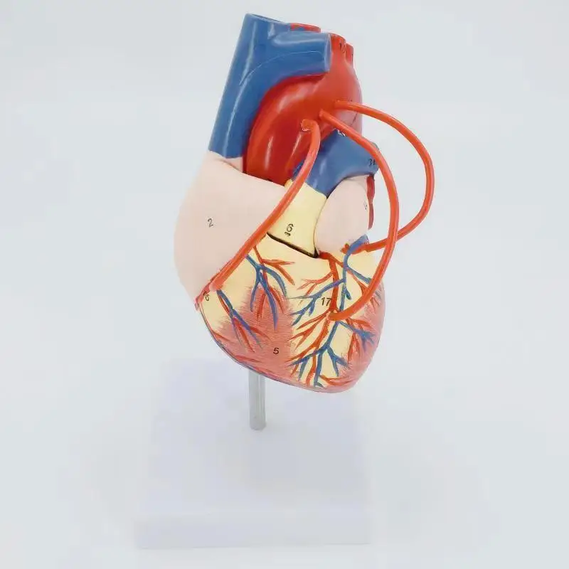 

coronary bypass operation demo model Cardiac anatomy model