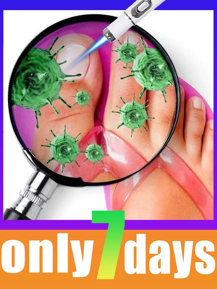 

Горячие продажи инструментов для ухода за ногтями 2025 года. Скажи добро пожаловать проблемы с ногтями. Второе поколение.