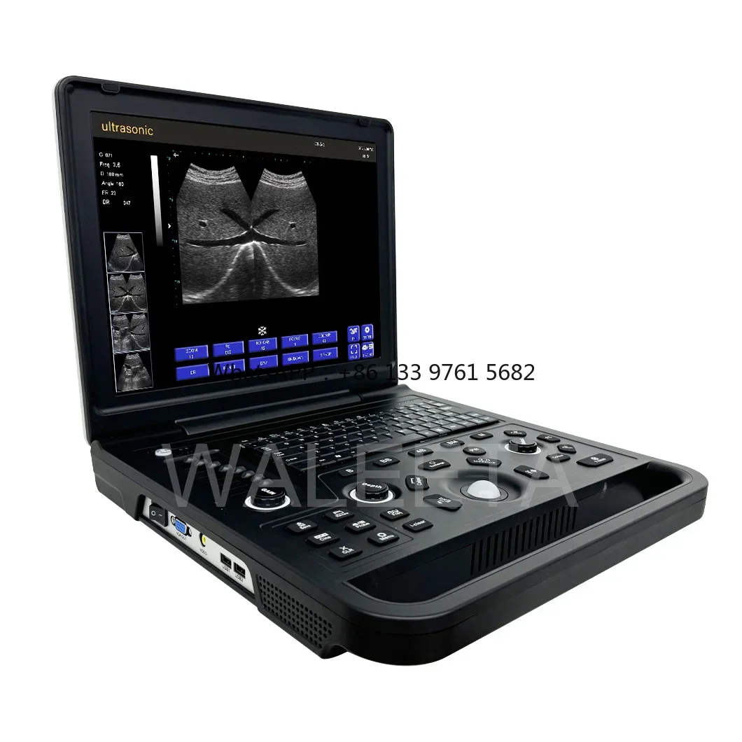 Best price Hospital Medical echographe portable white and black ultrasound for manufacture sale