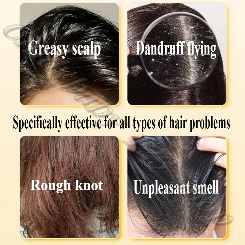 شامبو زيت الزيتون العطري يزيل ويقمع زيت الرأس الرقيق والنعومة ويحسن العطر والعطر الدائم 500 جرام