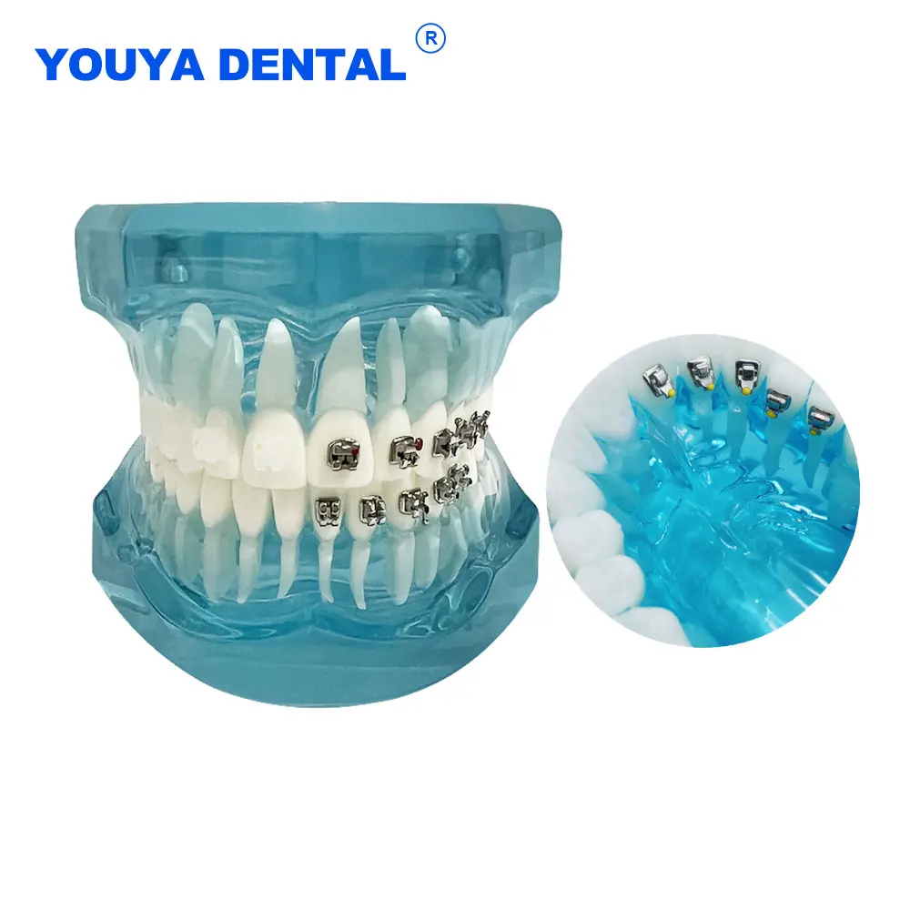 Dental Orthodontic Teeth Model with Ceramic Metal Self-Ligating Bracket Lingual Four Brackets Comparison Models Dentistry Teachi