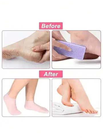 4pcs/2 Pairs Elastic Silicone Moisturizing Foot Socks For Dry Cracked Feet Foot Care Socks Massage Moisturizing