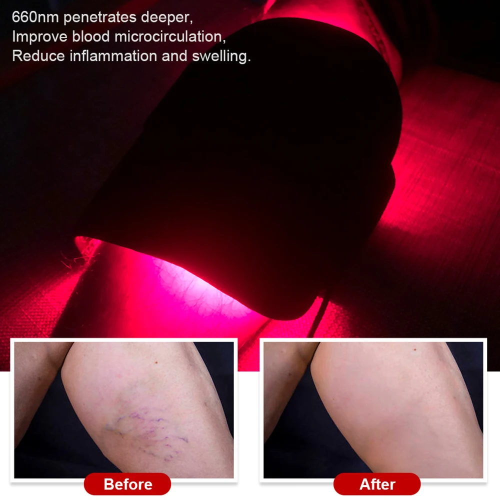 

Пояс для терапии ближнего инфракрасного красного света, носимое устройство 660, 850 нм, светодиодная обертка для глубокой терапии для облегчения боли в теле, мышц талии, лучший подарок