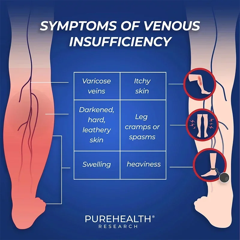 Varicose Veins Blood Circulation Supplement - Micronized Citrus Flavonoids, Horse Chestnut for Circulation, Veins & Blood Flow