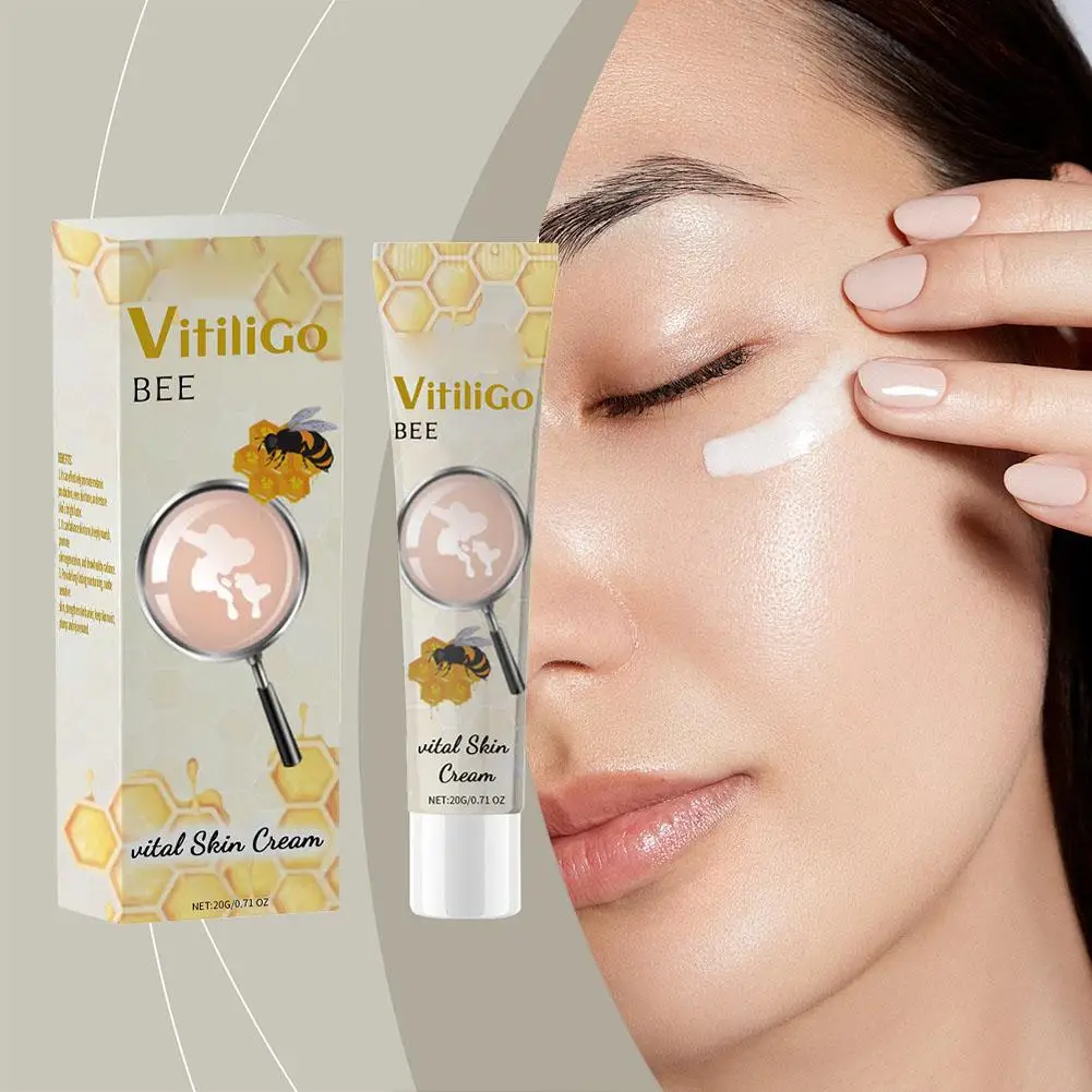 Crème éclaircissante vitale pour la peau, élimine les taches de rousseur, les taches foncées Melasma, éclaircit, dissolvant de taches blanches, 20g