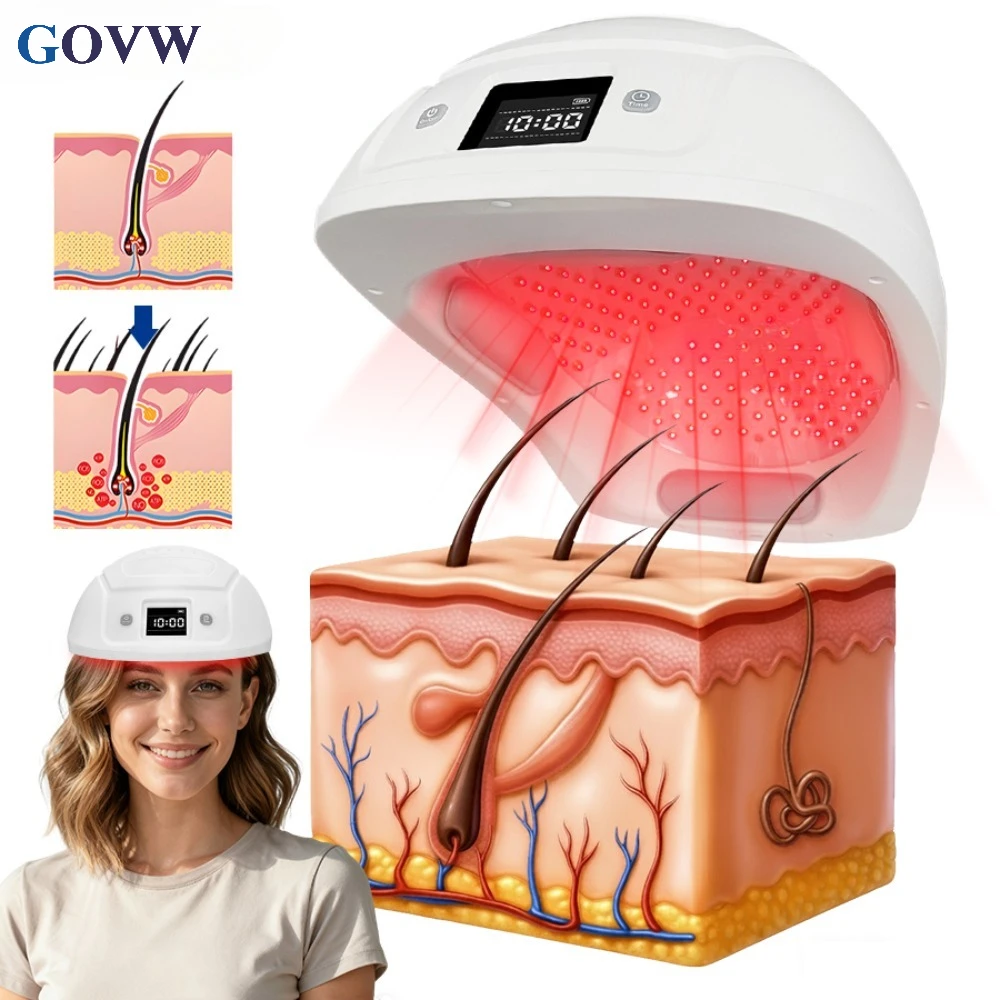GOVW Advanced 448 Diodes Cold Laser Therapy Helmet 650nm LLLT Physical Therapy Device for Hair Loss Thinning Repair Treatment