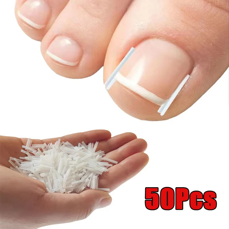 Ingrown Toenail Correction Tool Ingrown Toe Nail Treatment Elastic Patch Sticker Straightening Clip Brace Pedicure Tool