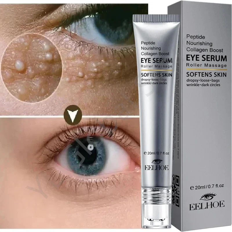 

Fat Granules Remover Eye Serum Roller Anti Dark Circle Eye Bag Fade Fine Line Anti-Puffiness Moisturizer Cream Skin Care Product