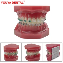 Normal Dental Orthodontic Teeth Model With Brace Half Metal Half Ceramic Standard Teaching Model Dental Teeth Model For Studying