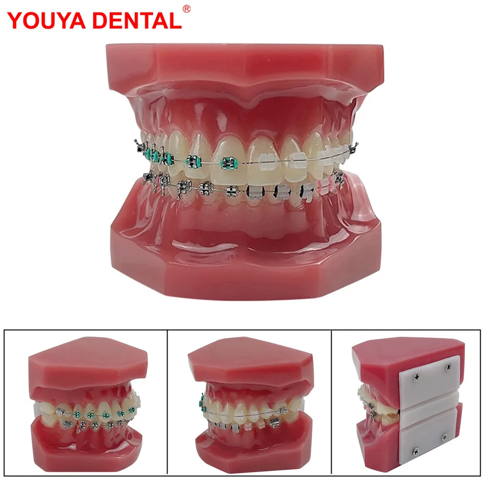 Normal Dental Orthodontic Teeth Model With Brace Half Metal Half Ceramic Standard Teaching Model Dental Teeth Model For Studying