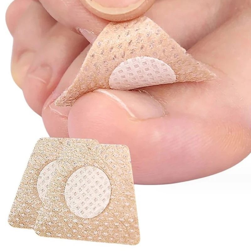 Pegatinas de corrección de uñas encarnadas, parches para el cuidado de los pies, tratamiento de paroniquia, herramienta de pedicura, 2/10 piezas