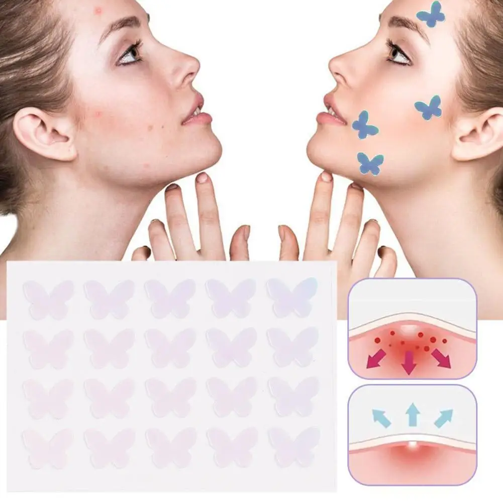 20pcs Acne Pimple Patch Invisible Acne Removal Stickers Butterfly Blemish Treatment Acne Master Pimple Remover Stickers