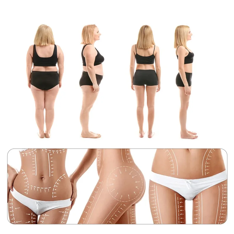 TUNIN-Huile essentielle amincissante pour le ventre, Eva de graisse, cuisse fine, bras, ventre, corps saillant, anti-cellulite, Roll-On valide