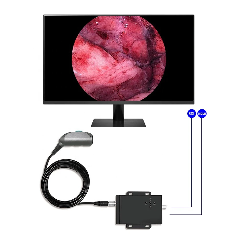 TUYOU FHD Portable Endoscope Camera System